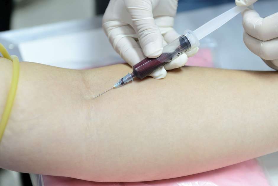 teste-hiv-agulha-exame-sangue-getty